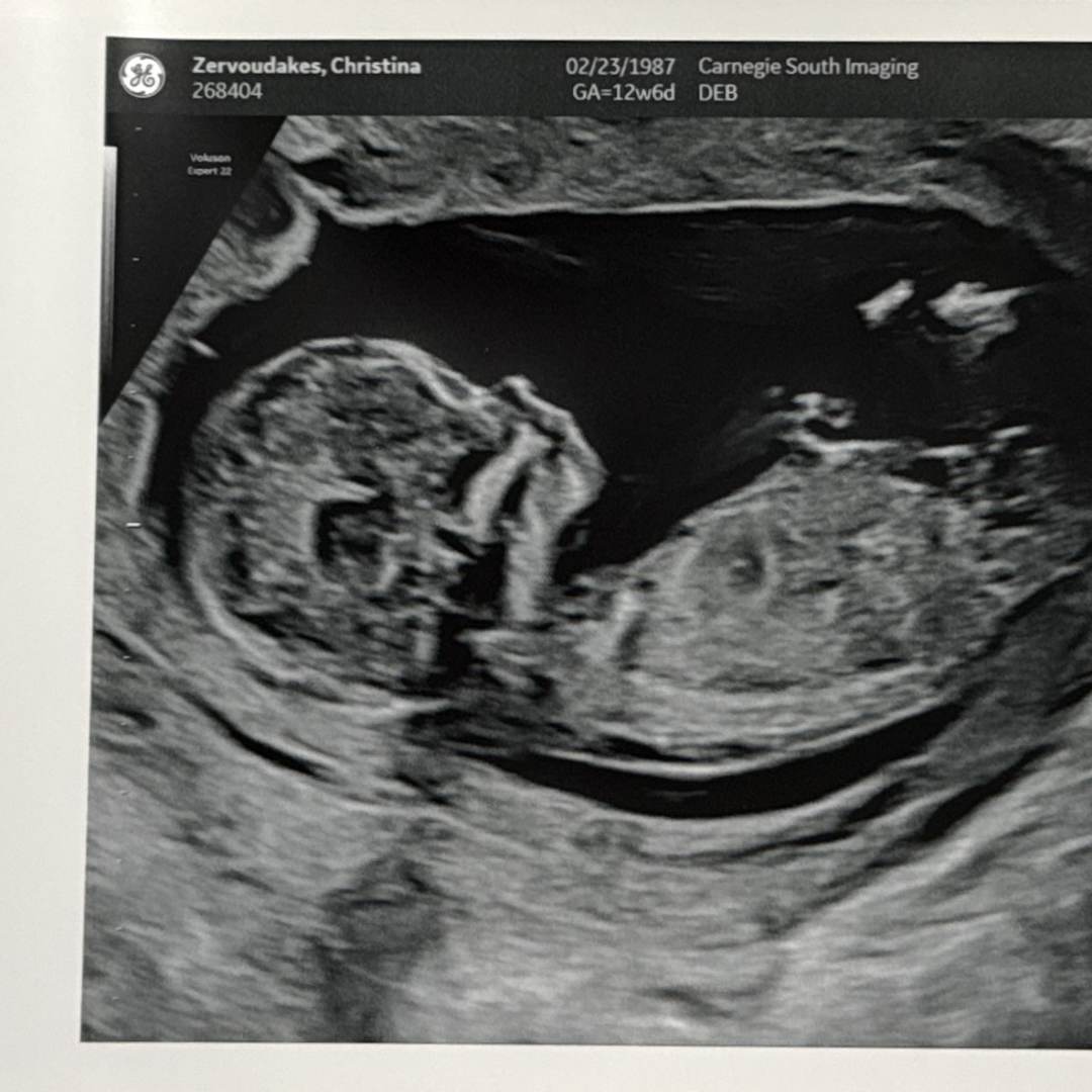 Photo shared by Christina for their Babylist baby registry.