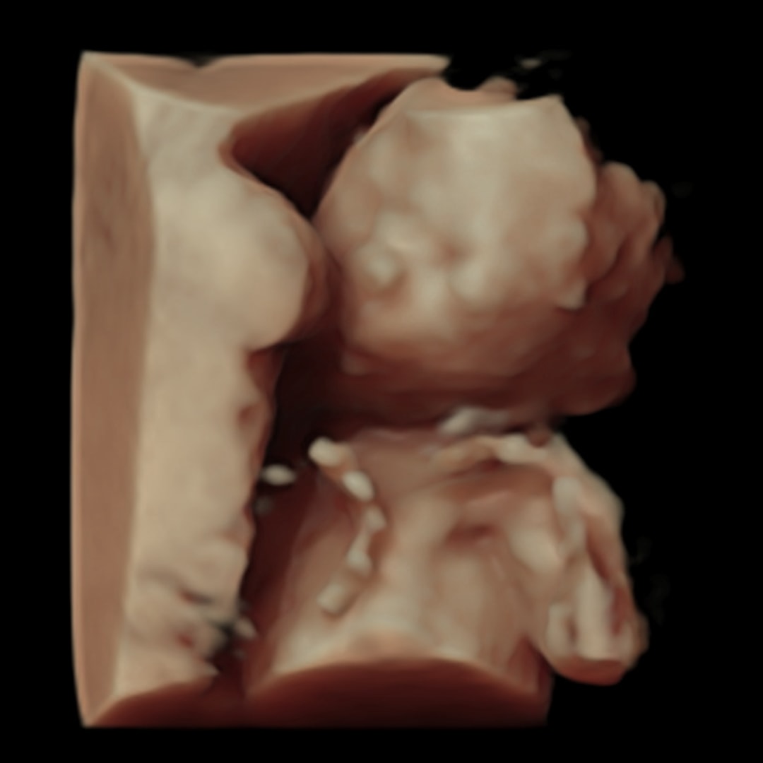 Photo shared by Sara for their Babylist baby registry.