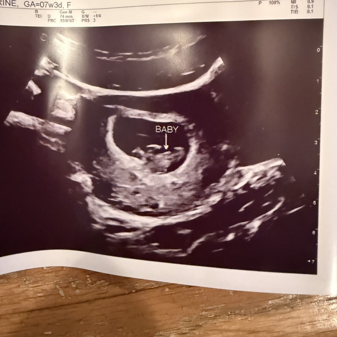 Photo shared by Catherine for their Babylist baby registry.