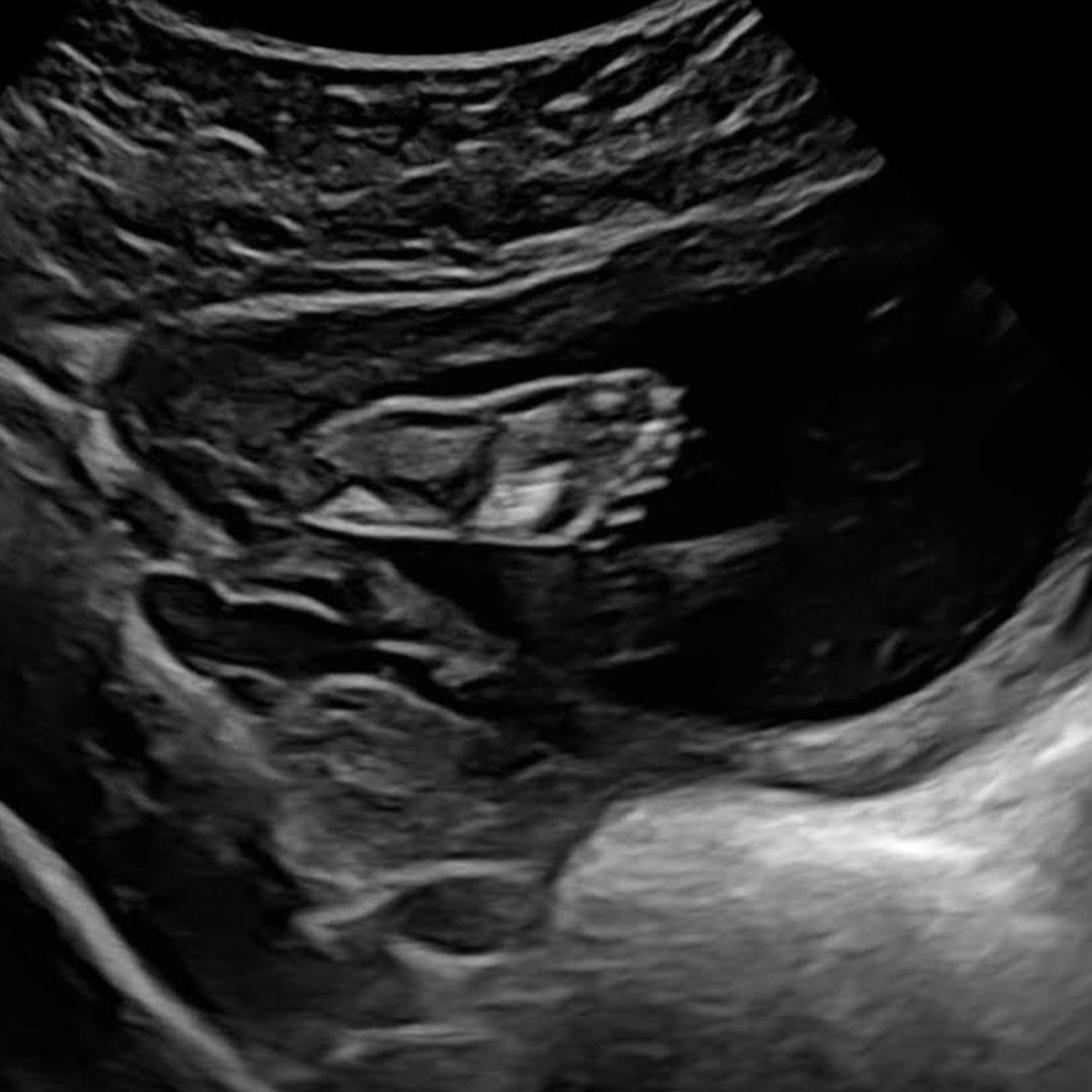 Photo shared by Autum for their Babylist baby registry.