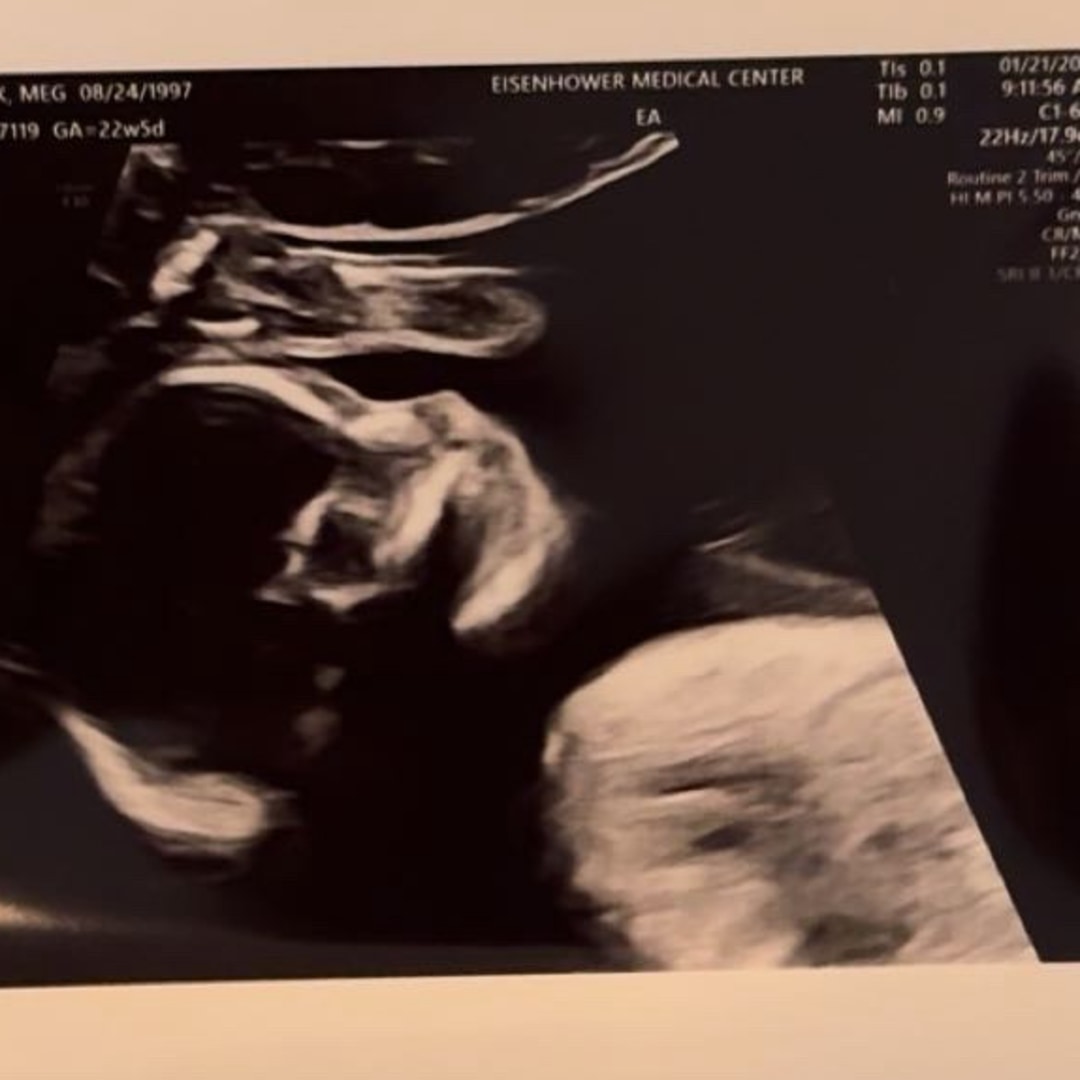 Photo shared by Meg for their Babylist baby registry.