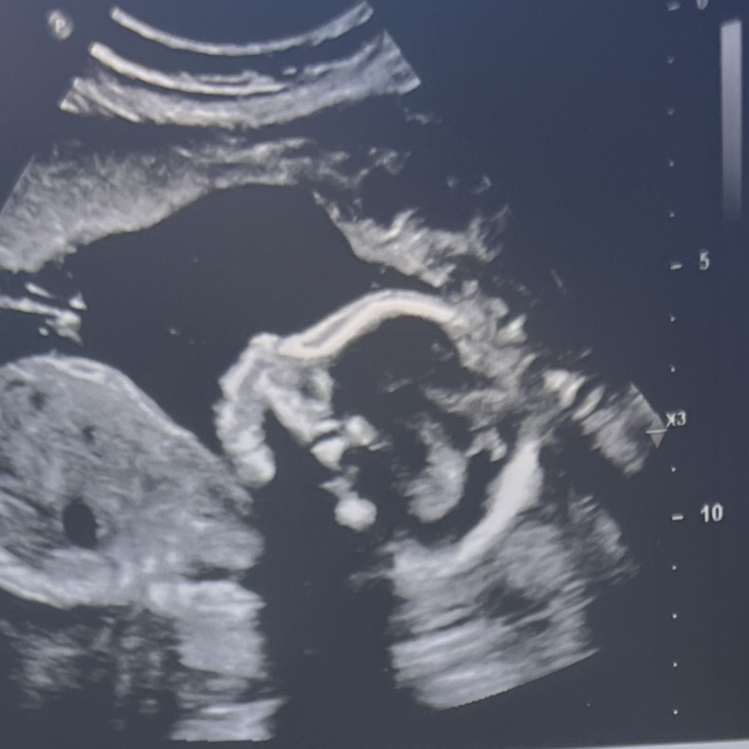 Photo shared by Madisun for their Babylist baby registry.