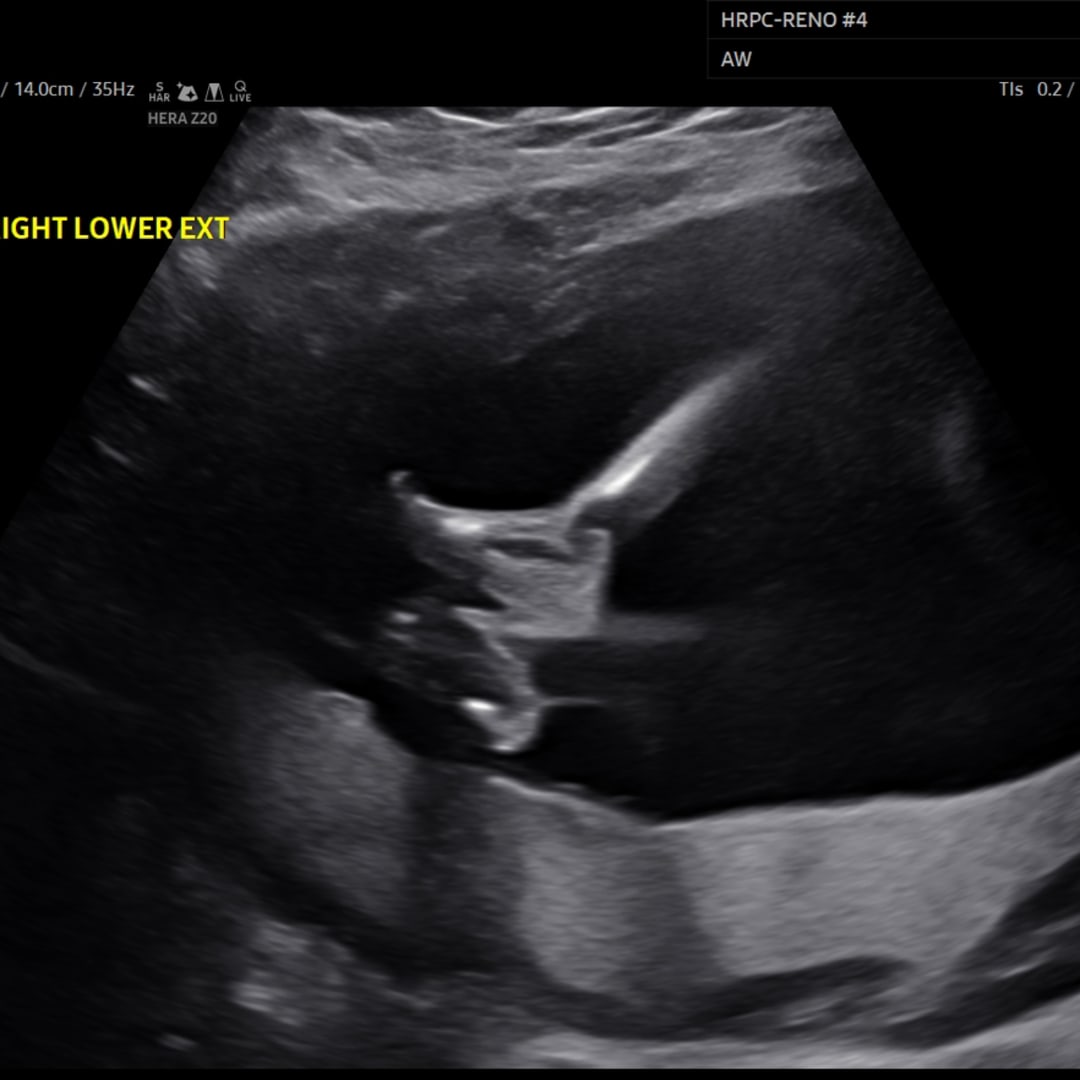 Photo shared by Skye for their Babylist baby registry.