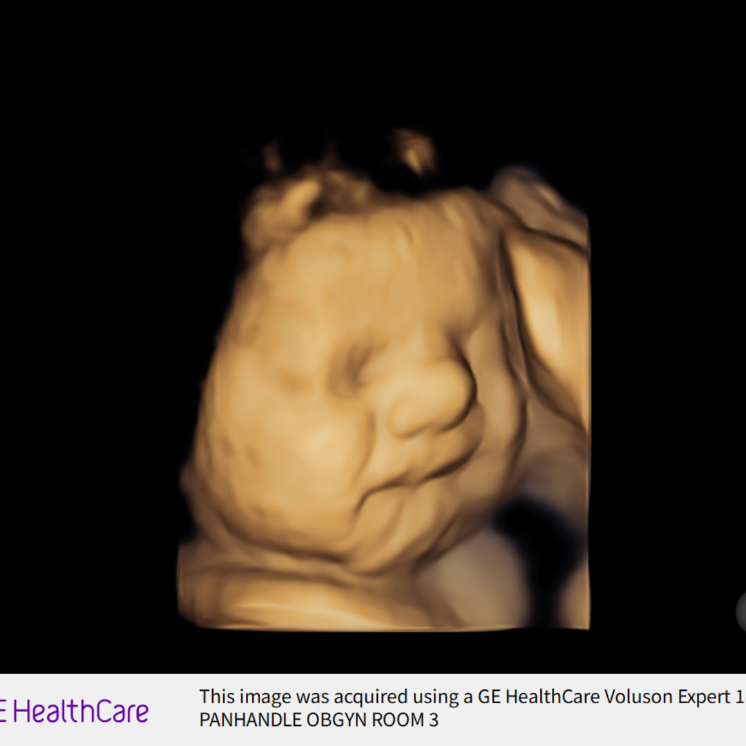 Photo shared by Lindi for their Babylist baby registry.