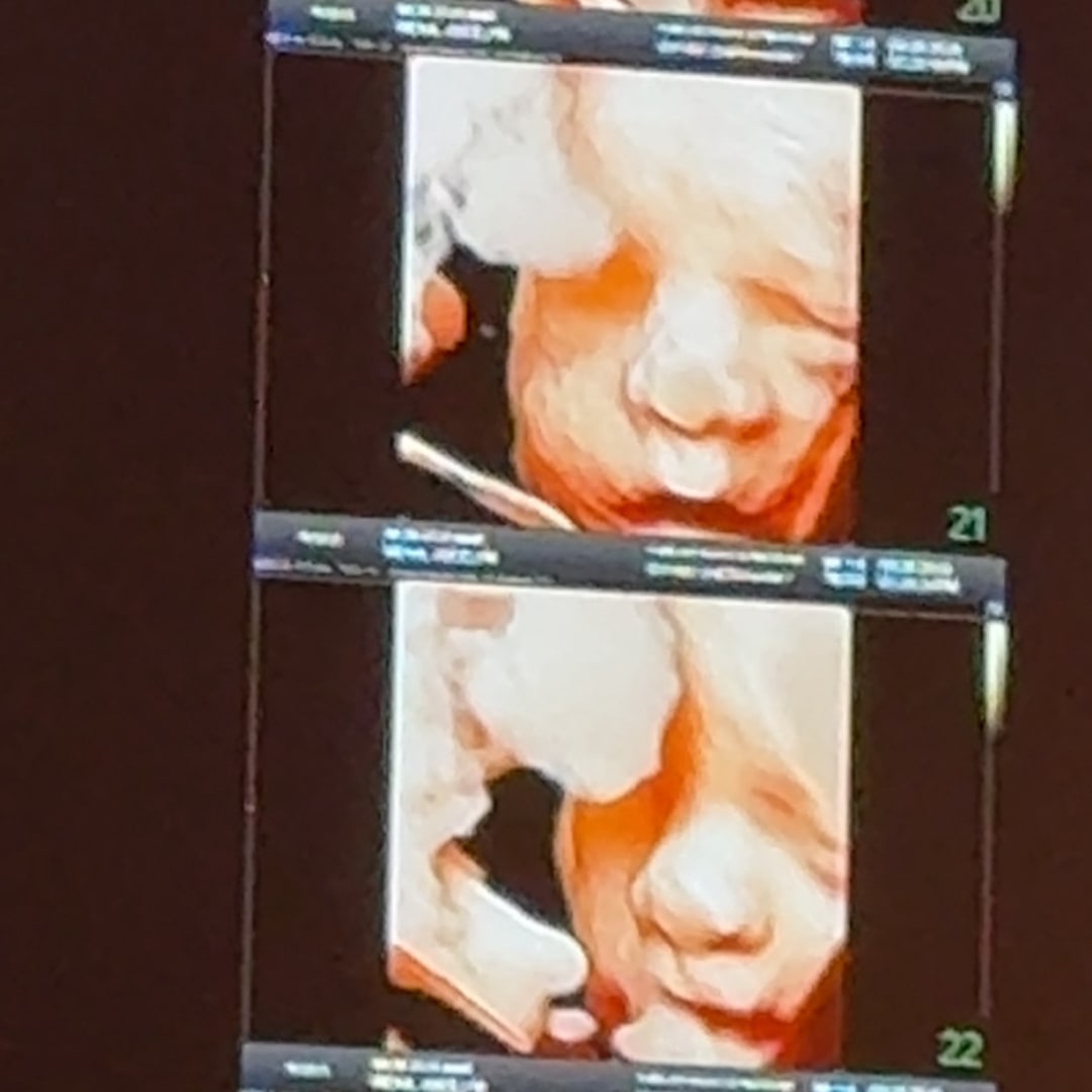 Photo shared by Jocelyn for their Babylist baby registry.