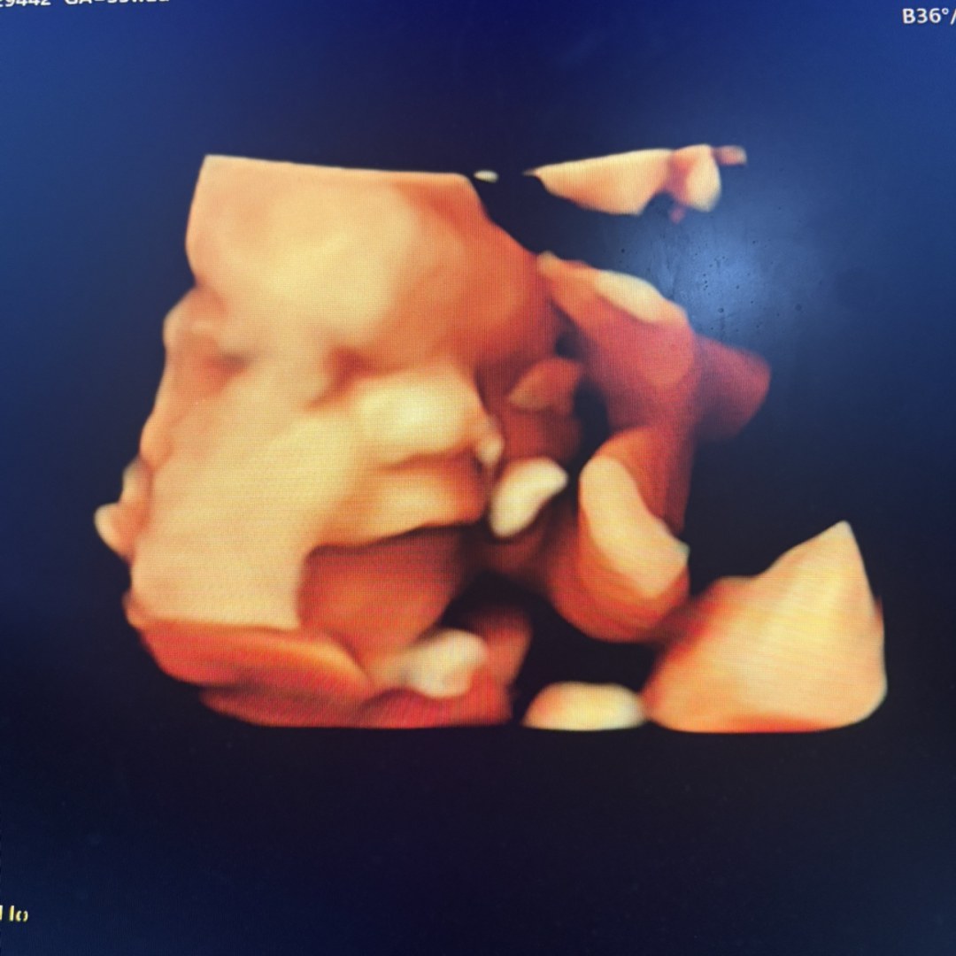 Photo shared by Aviana for their Babylist baby registry.