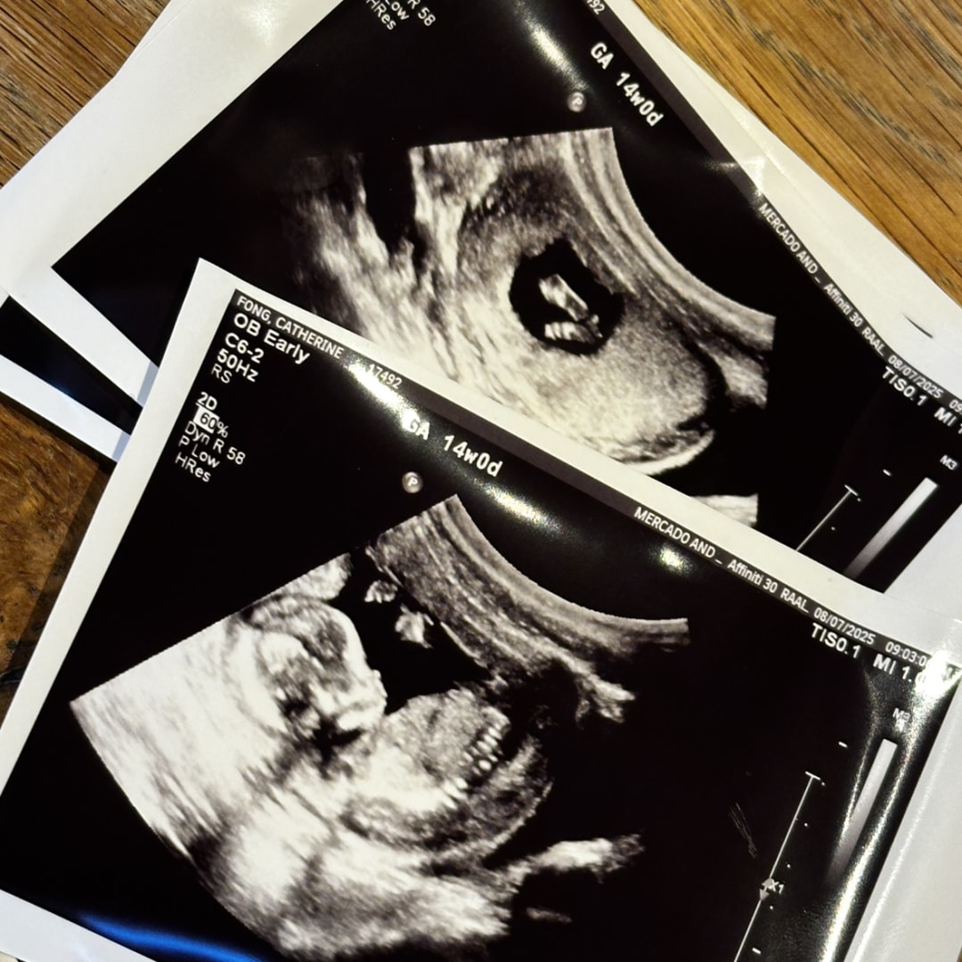 Photo shared by Catherine for their Babylist baby registry.
