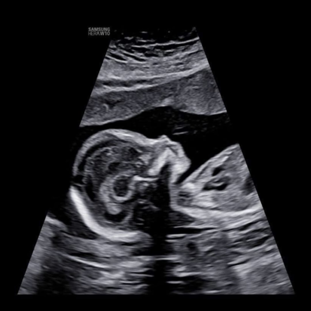 Photo shared by Tori for their Babylist baby registry.