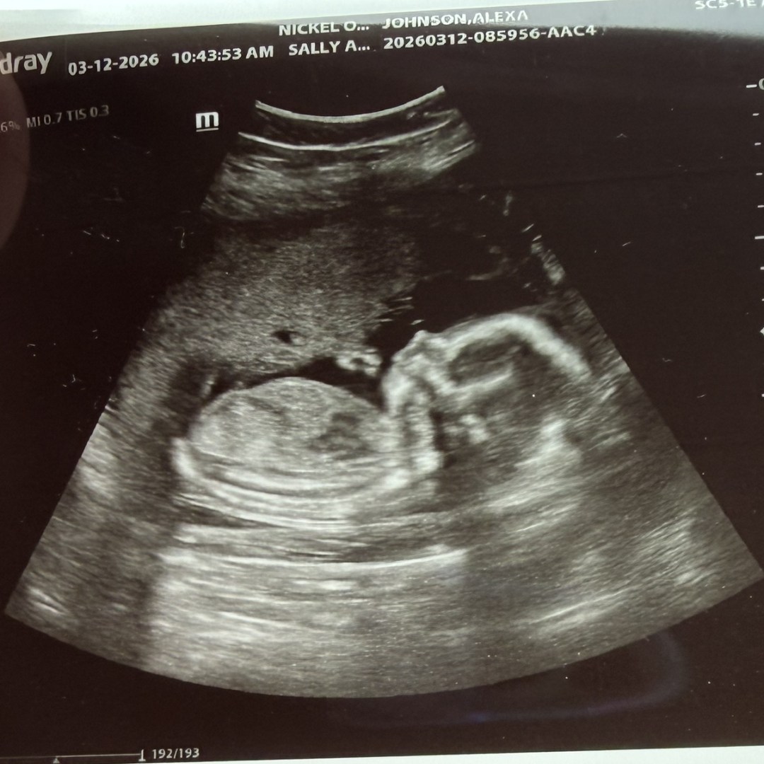 Photo shared by Lexi for their Babylist baby registry.