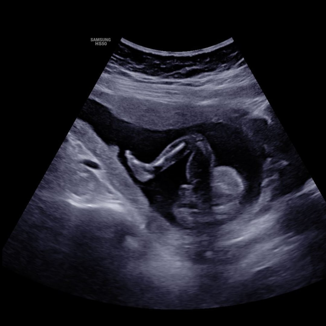 Photo shared by Alexis for their Babylist baby registry.