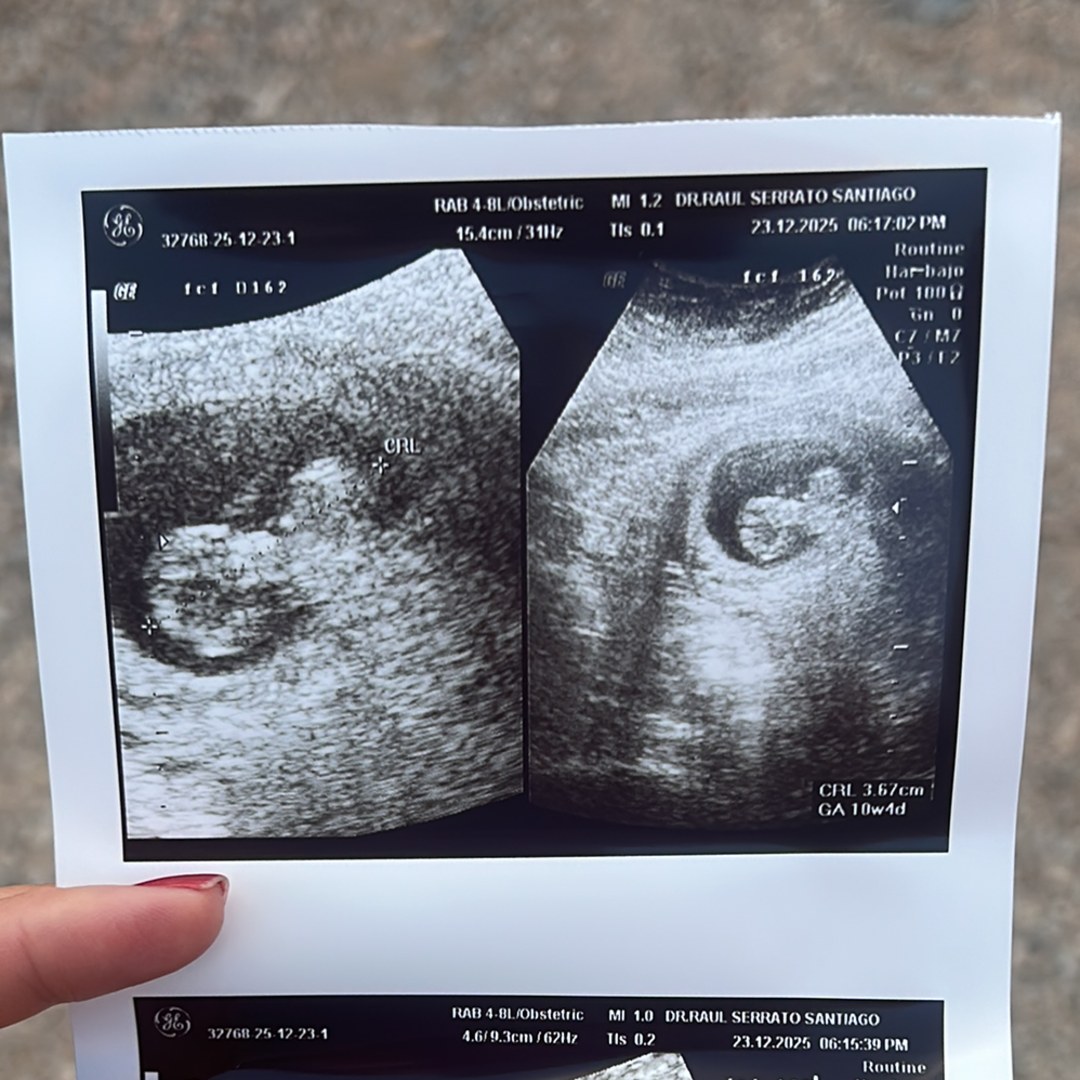 Photo shared by Belen for their Babylist baby registry.