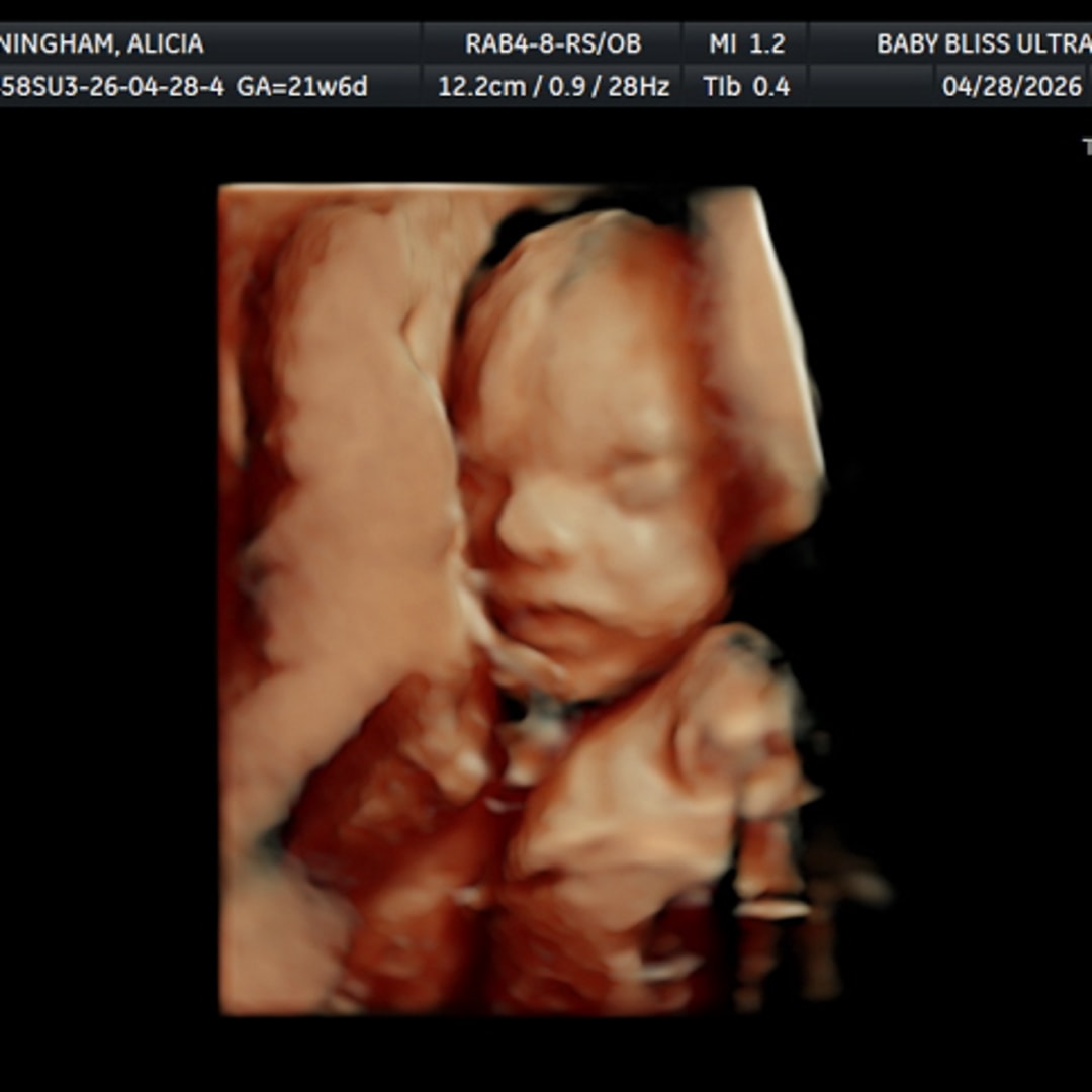 Photo shared by Alicia for their Babylist baby registry.