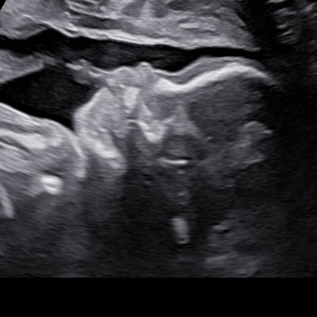 Photo shared by Dierra for their Babylist baby registry.