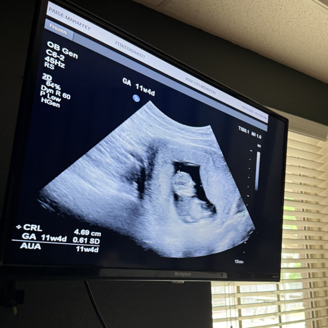 Photo shared by Paige for their Babylist baby registry.