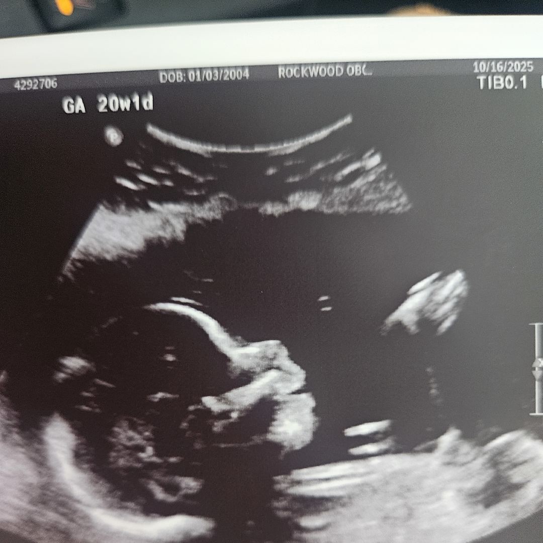 Photo shared by Cheyenne for their Babylist baby registry.