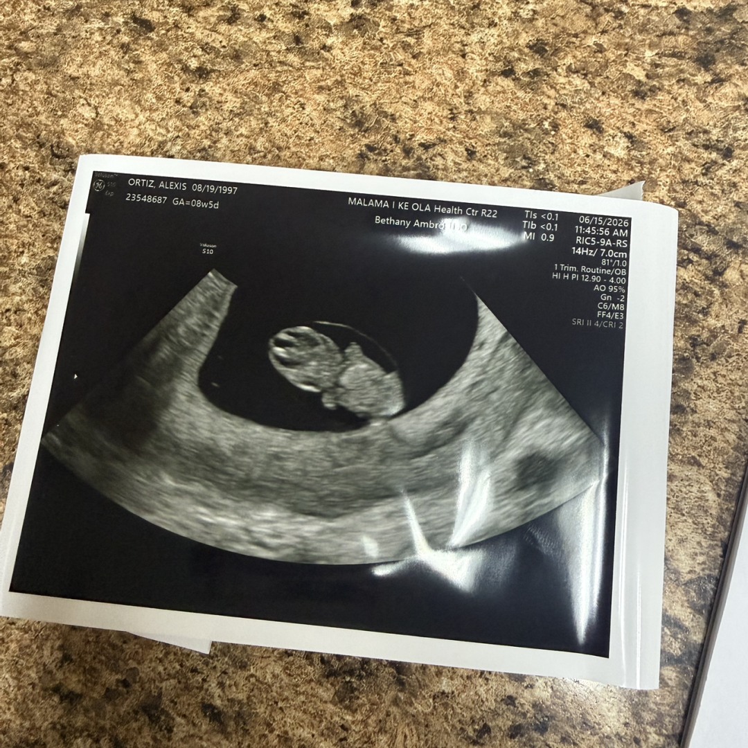 Photo shared by Alexis for their Babylist baby registry.