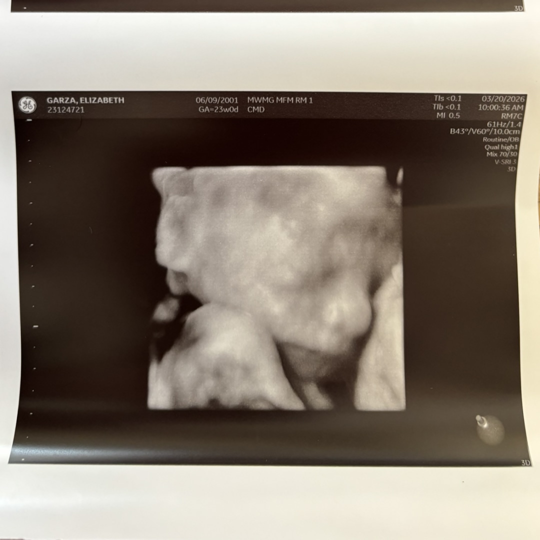 Photo shared by Elizabeth for their Babylist baby registry.