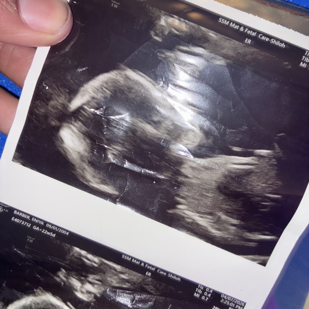 Photo shared by Eniya for their Babylist baby registry.