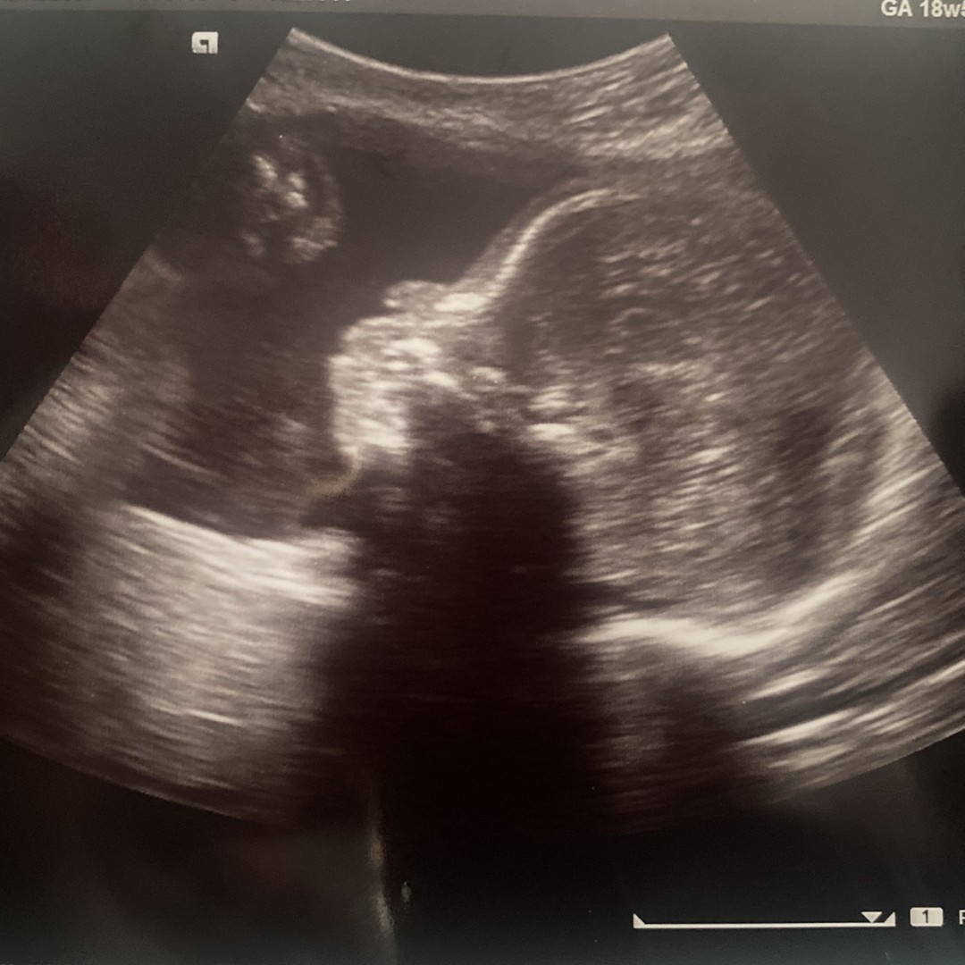 Photo shared by Ishayla for their Babylist baby registry.