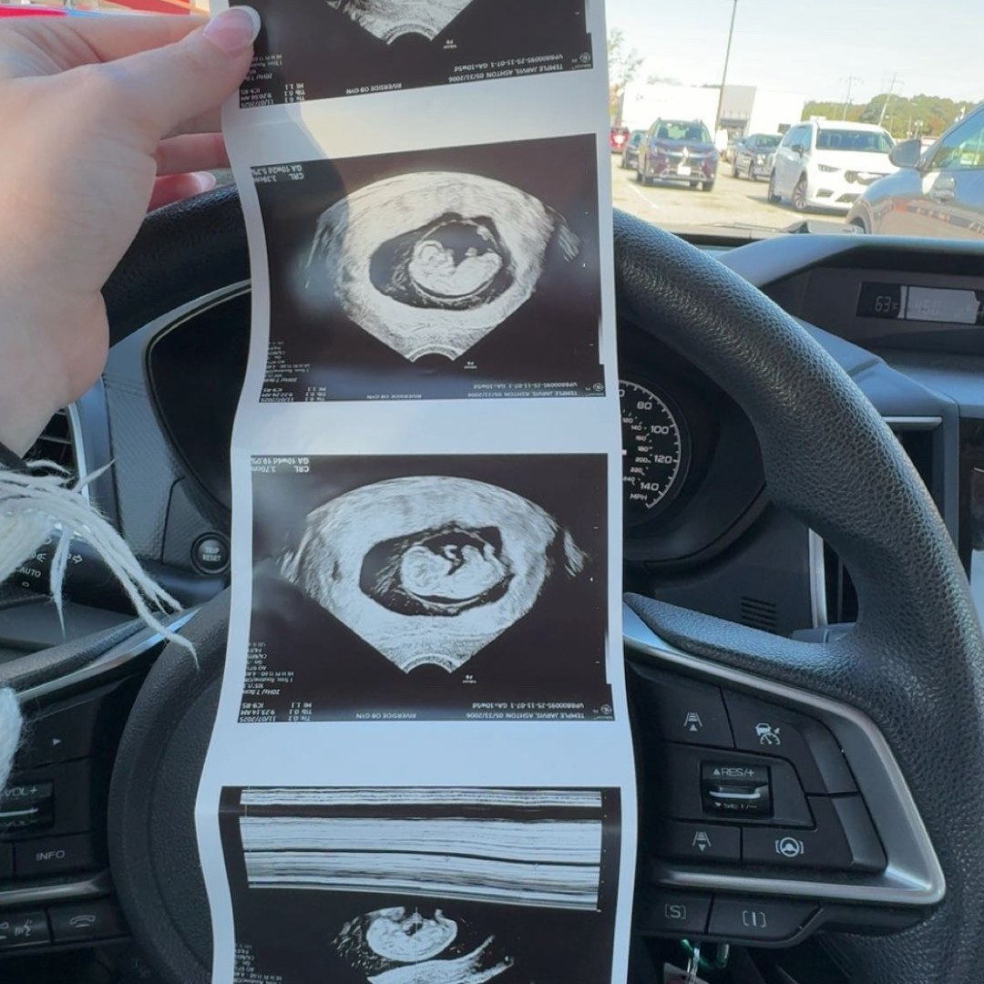 Photo shared by Ashton for their Babylist baby registry.