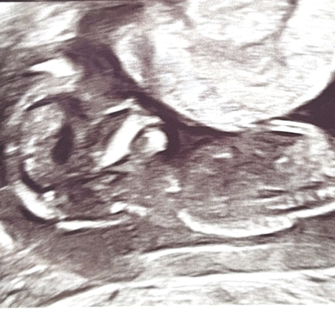 Photo shared by Bridget for their Babylist baby registry.