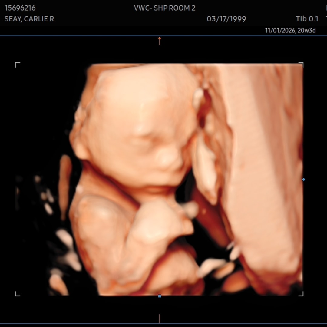 Photo shared by Carlie for their Babylist baby registry.