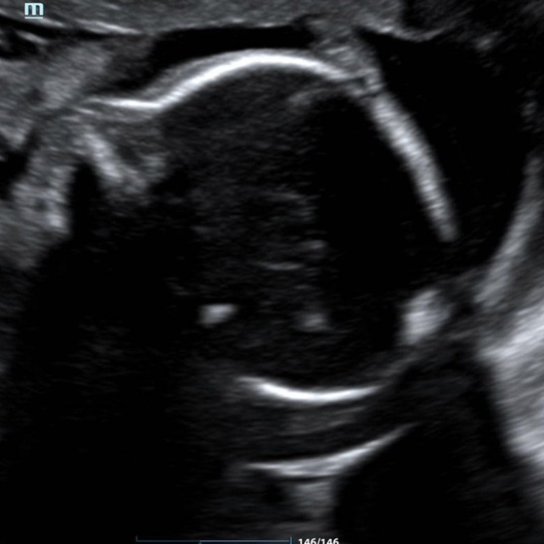 Photo shared by Miranda for their Babylist baby registry.