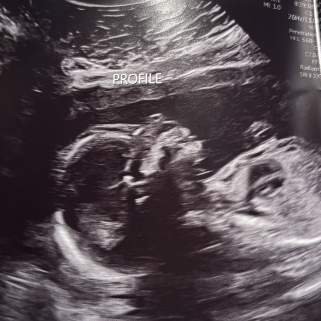 Photo shared by Hailey for their Babylist baby registry.