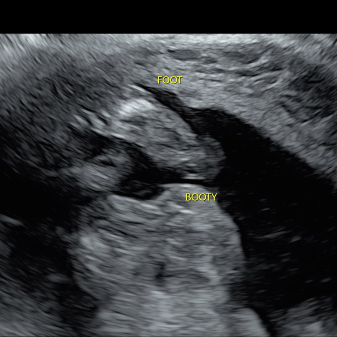 Photo shared by Shanerica for their Babylist baby registry.