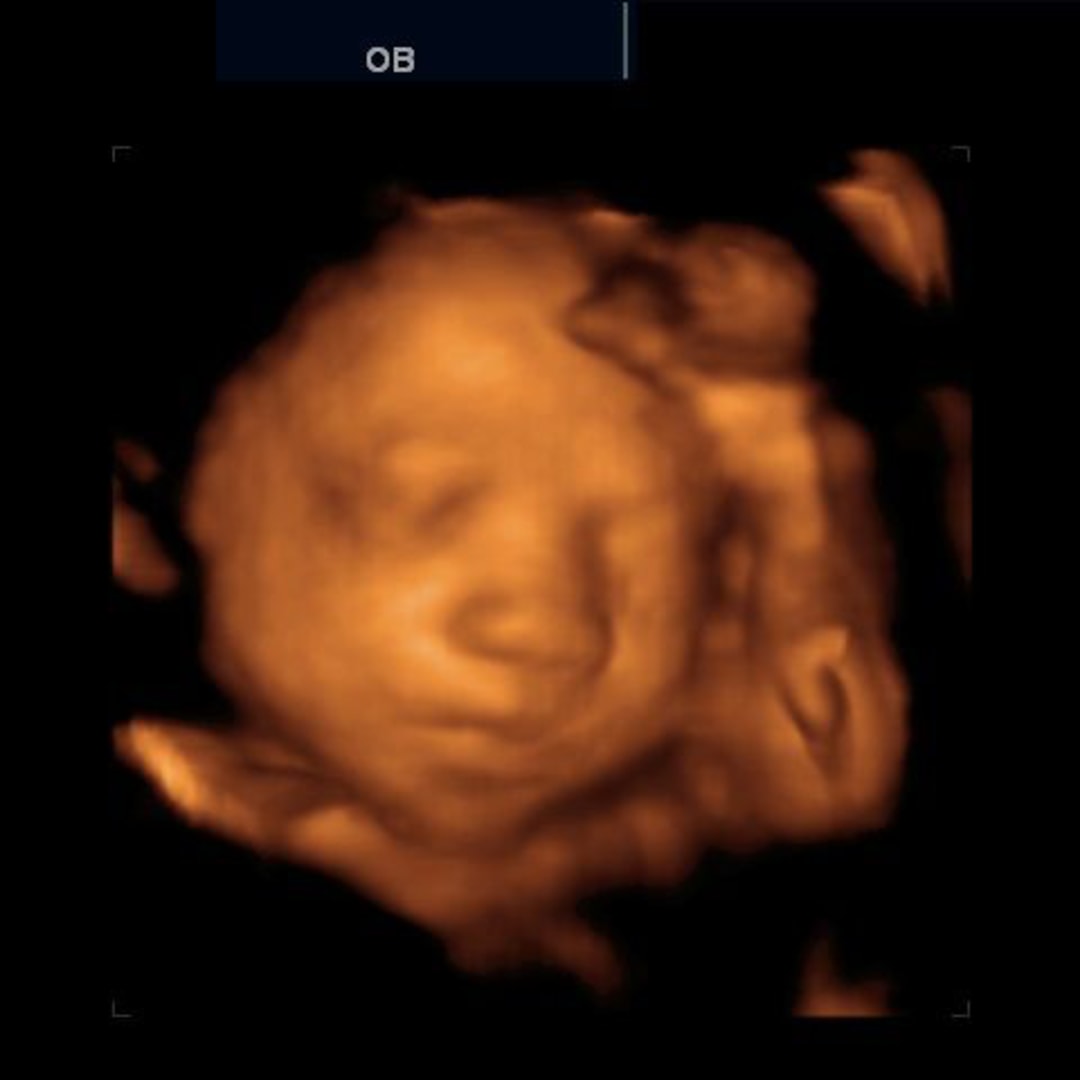 Photo shared by Hemritha for their Babylist baby registry.