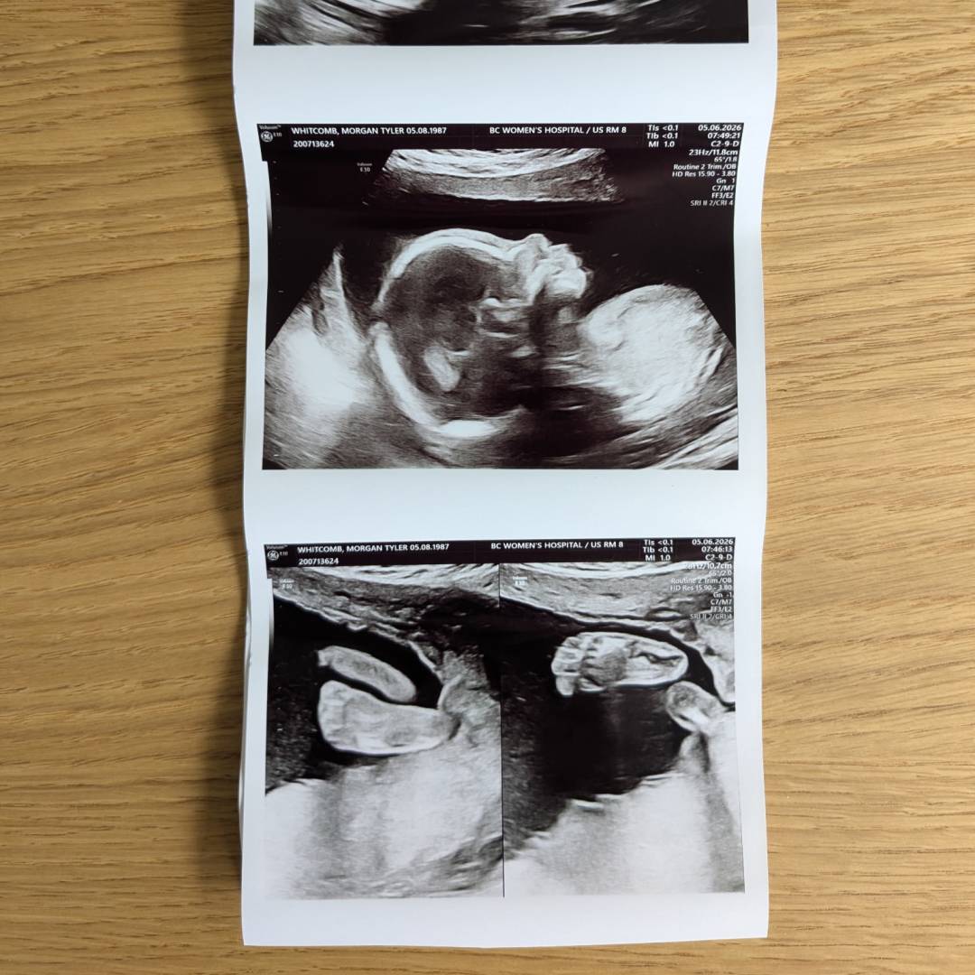 Photo shared by Morgan for their Babylist baby registry.