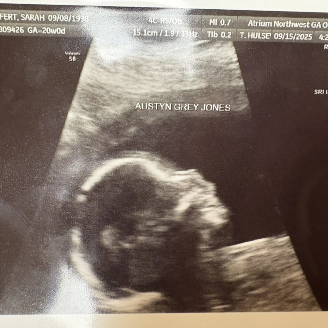 Photo shared by Sarah for their Babylist baby registry.