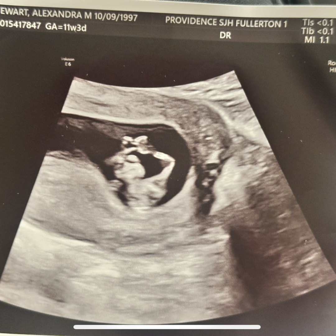 Photo shared by Alexandra for their Babylist baby registry.