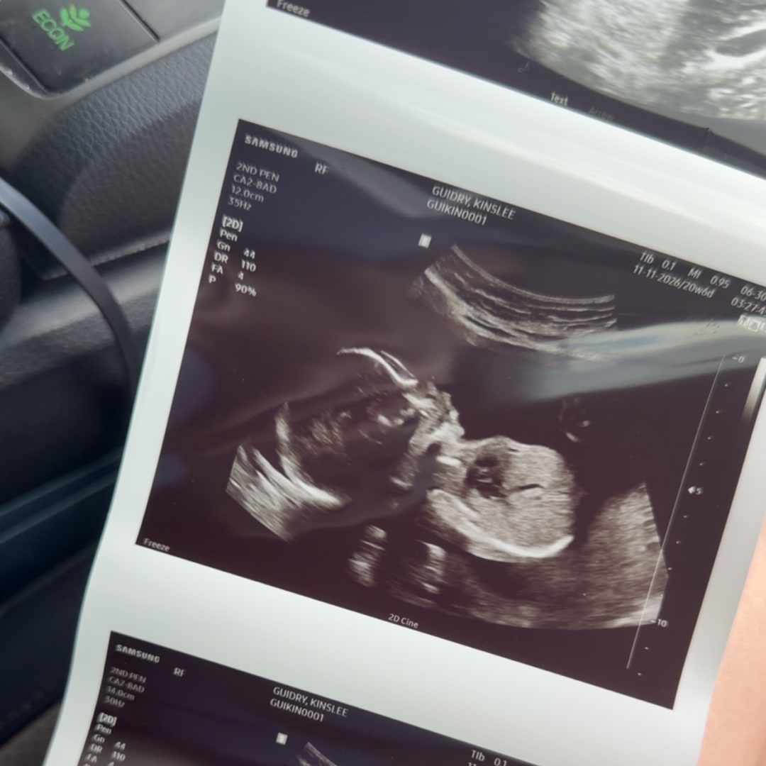 Photo shared by Kinslee for their Babylist baby registry.