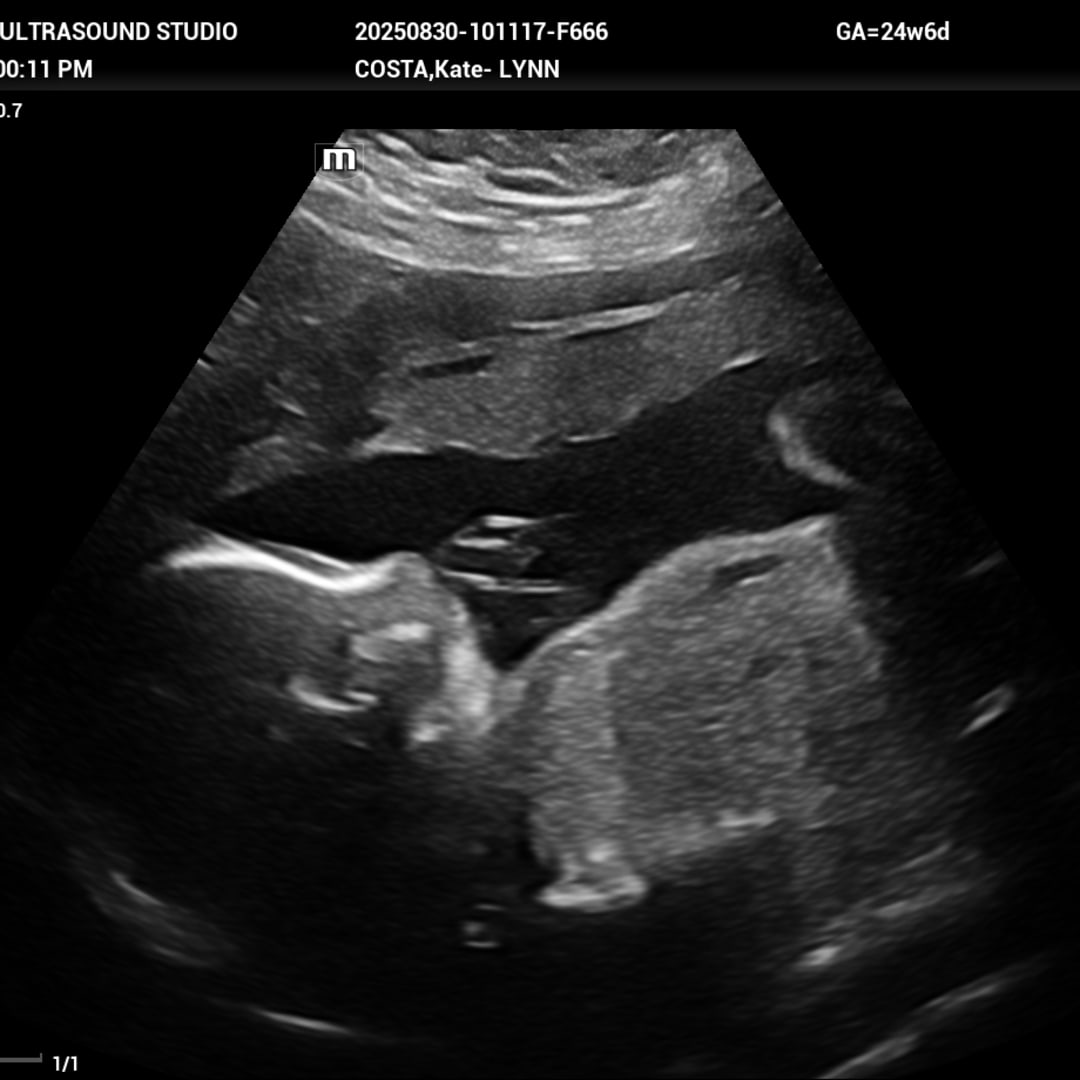 Photo shared by Kate-Lynn for their Babylist baby registry.