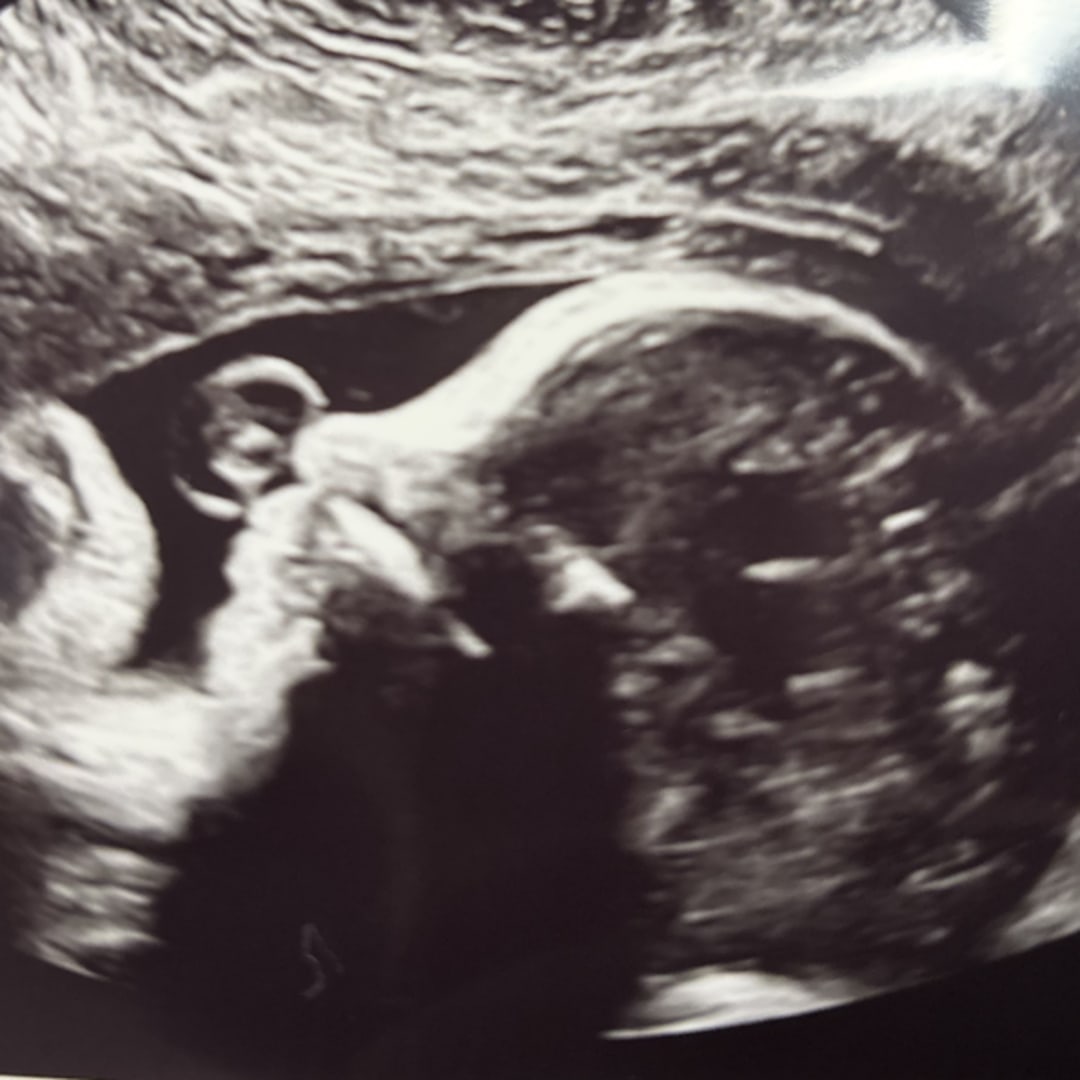 Photo shared by Jillian for their Babylist baby registry.