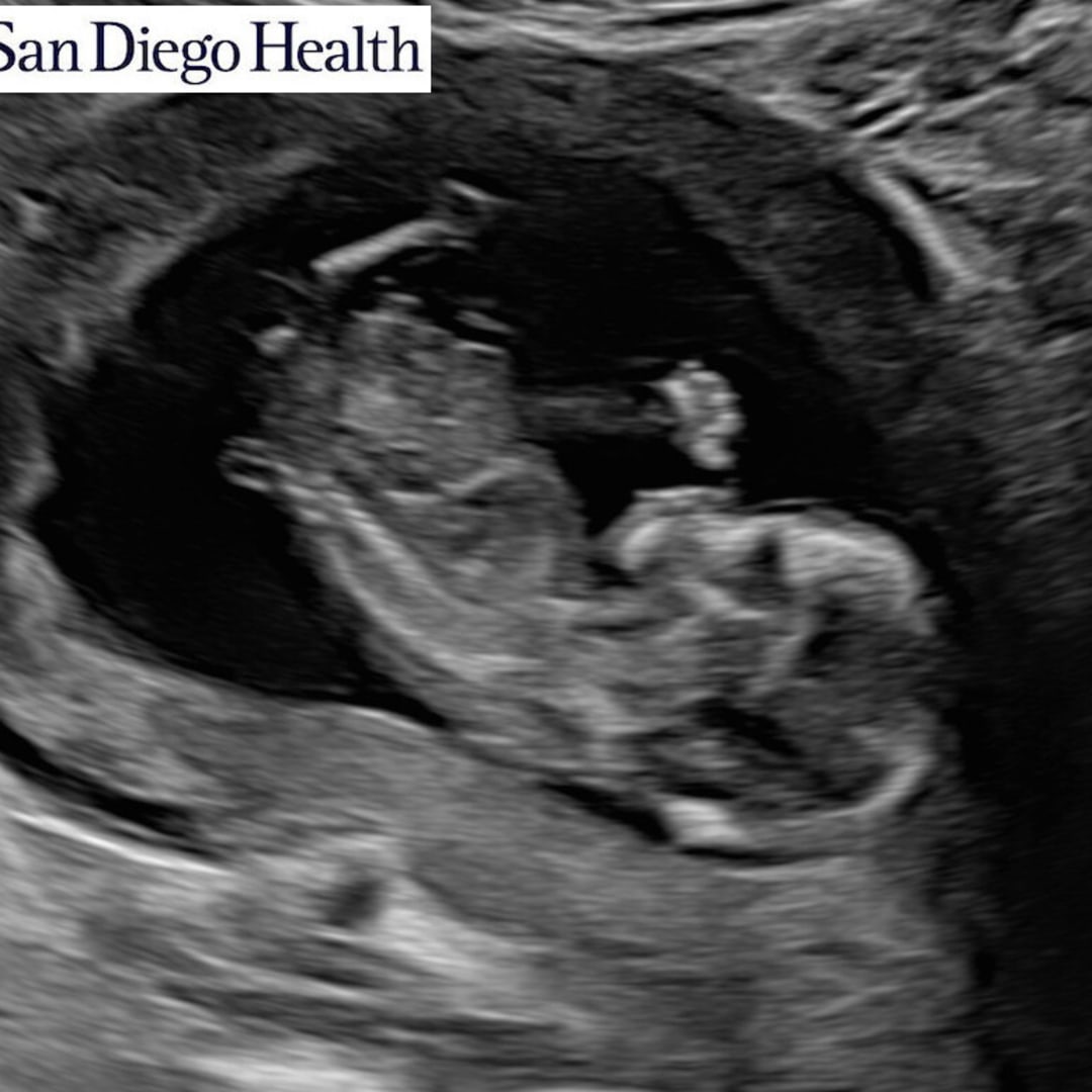 Photo shared by Haley for their Babylist baby registry.