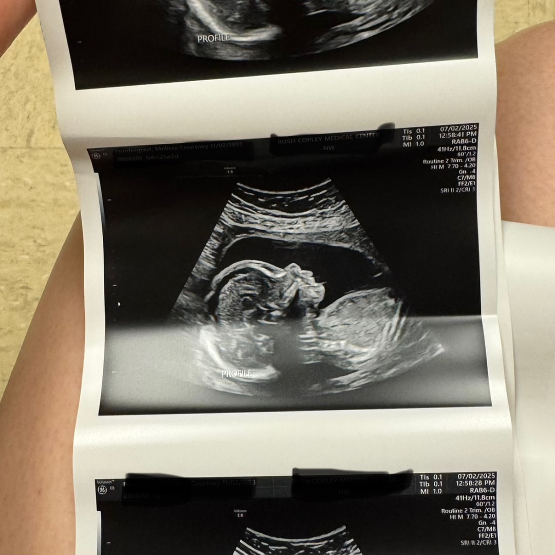 Photo shared by Melissa for their Babylist baby registry.