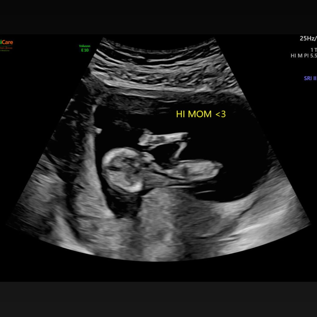 Photo shared by Alexandria for their Babylist baby registry.