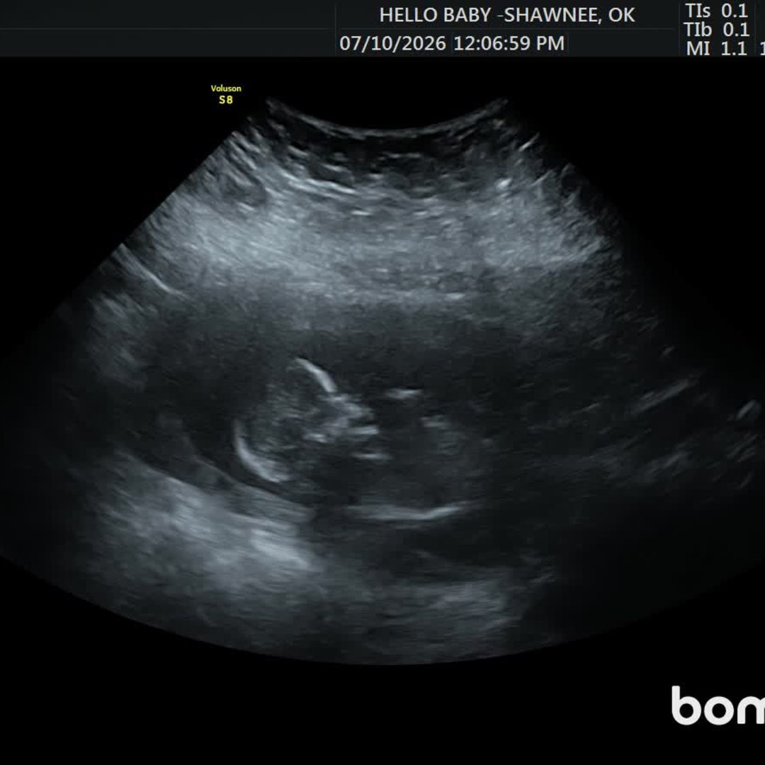 Photo shared by Kendra for their Babylist baby registry.