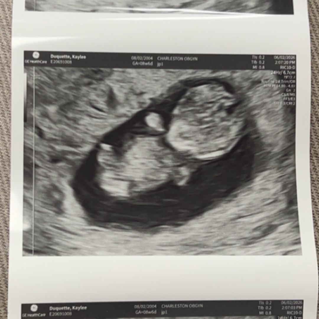 Photo shared by Kaylee for their Babylist baby registry.
