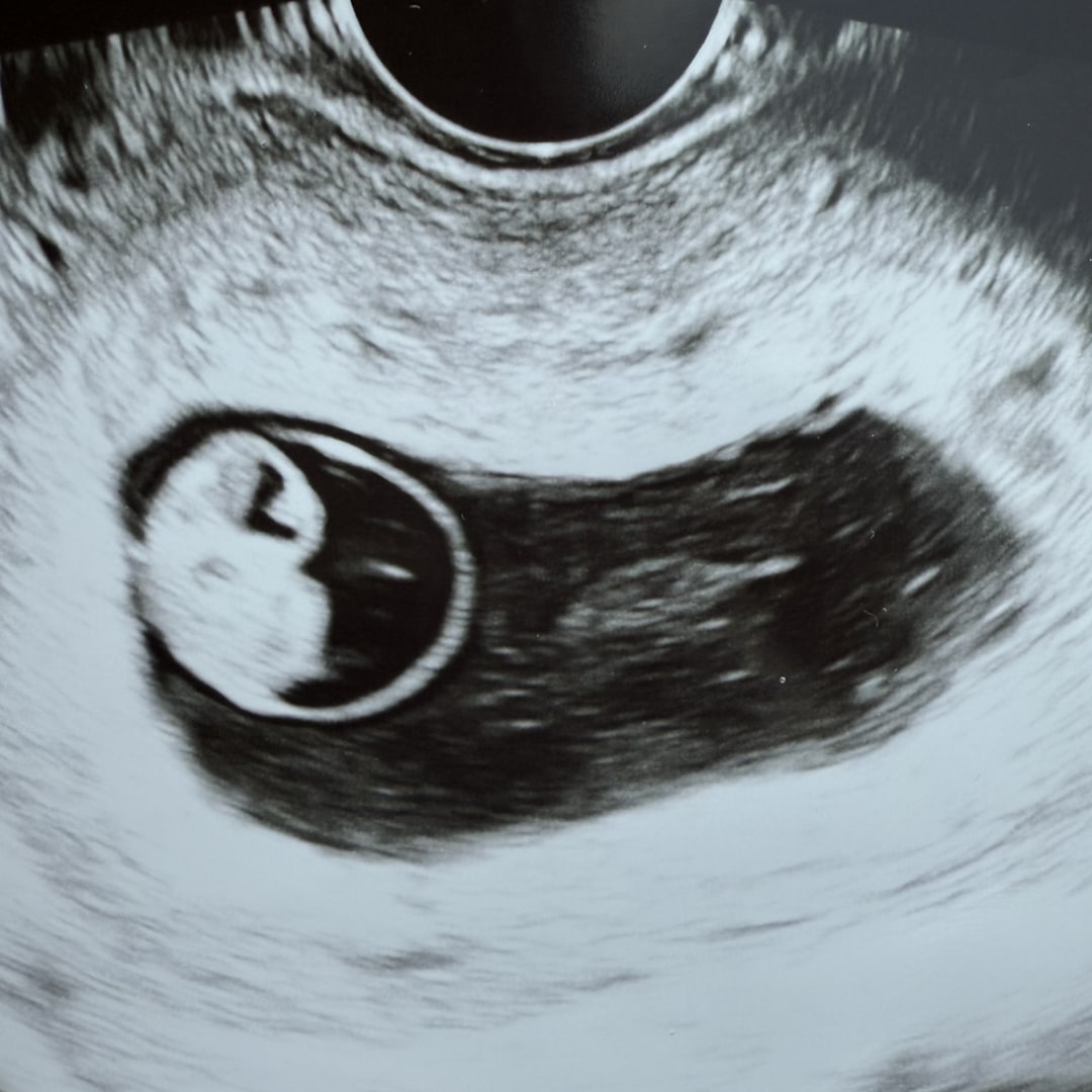 Photo shared by Serina for their Babylist baby registry.