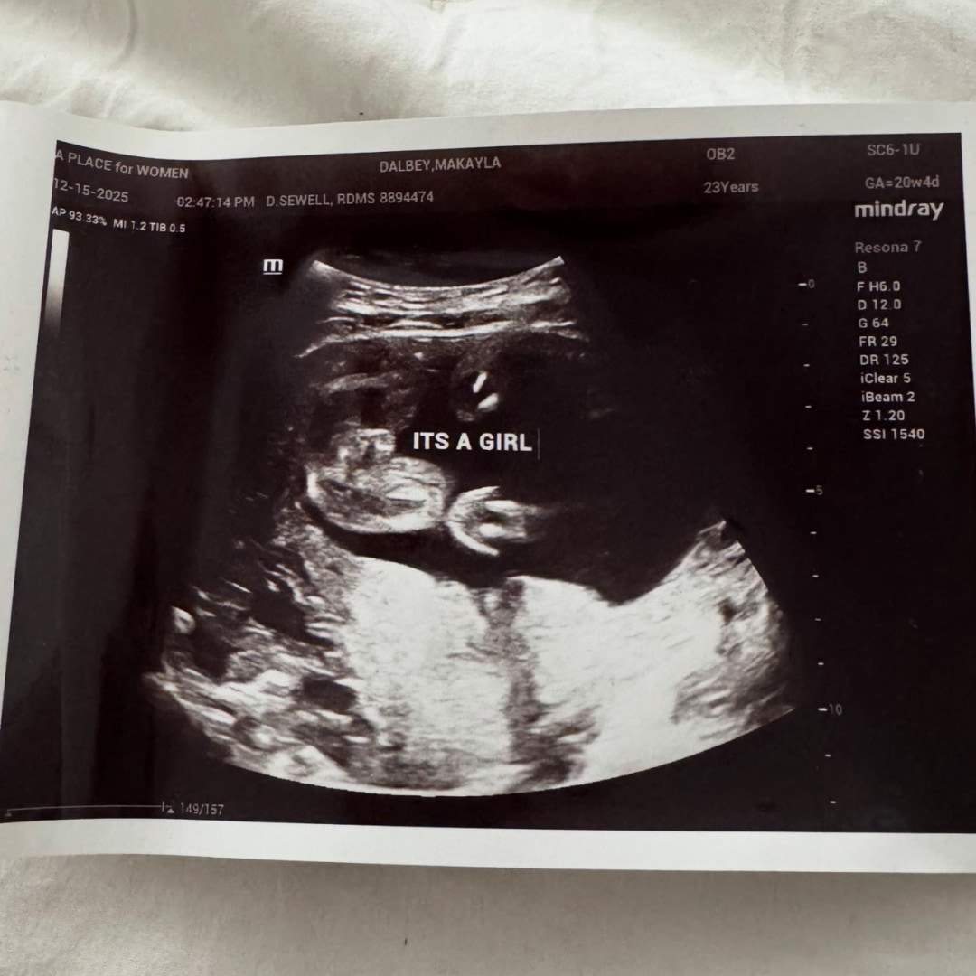 Photo shared by Makayla for their Babylist baby registry.