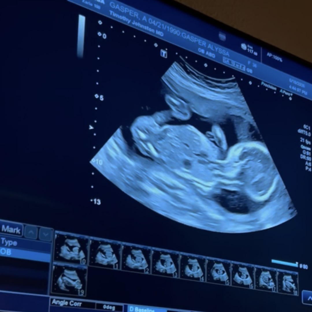 Photo shared by Alyssa for their Babylist baby registry.