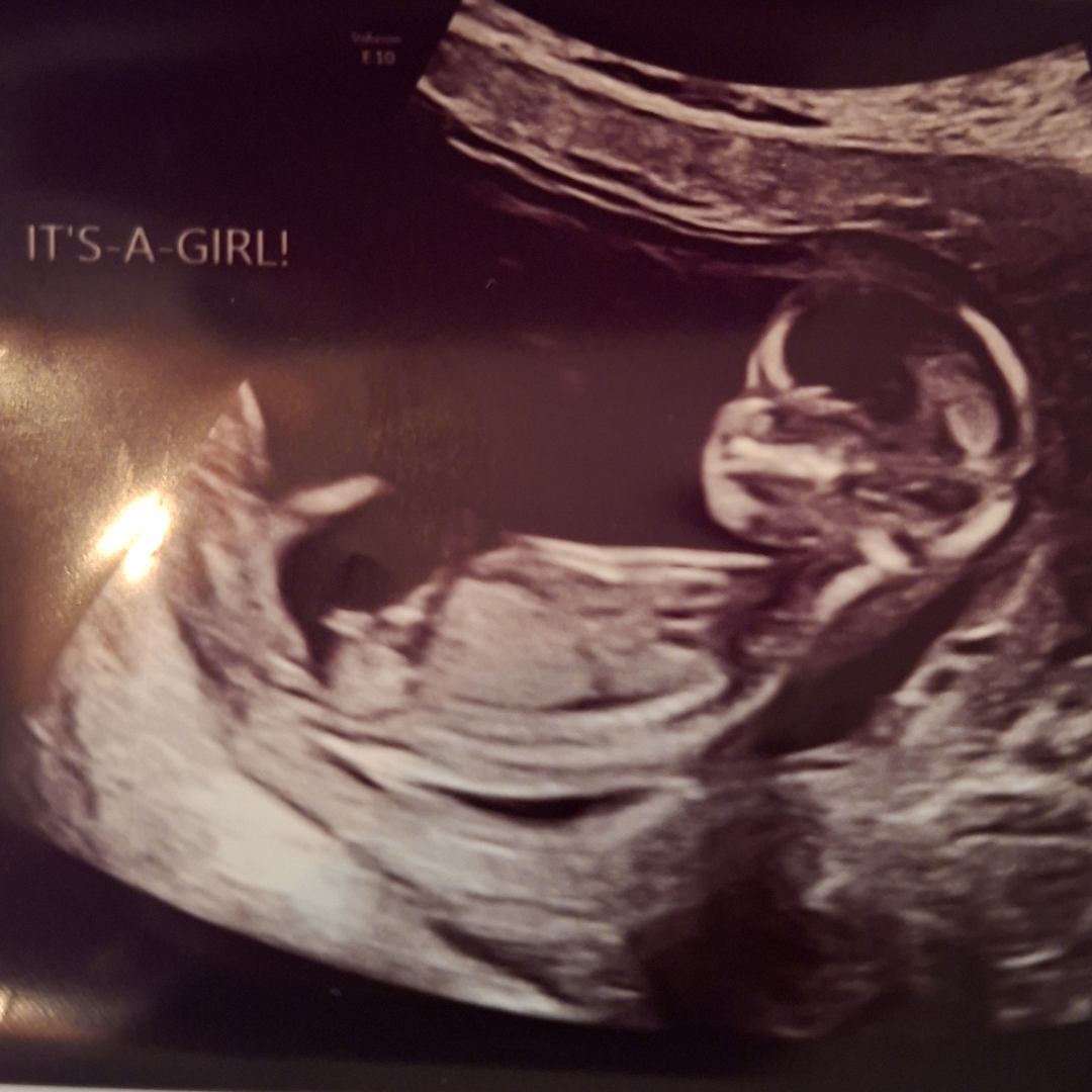 Photo shared by Arlenne for their Babylist baby registry.
