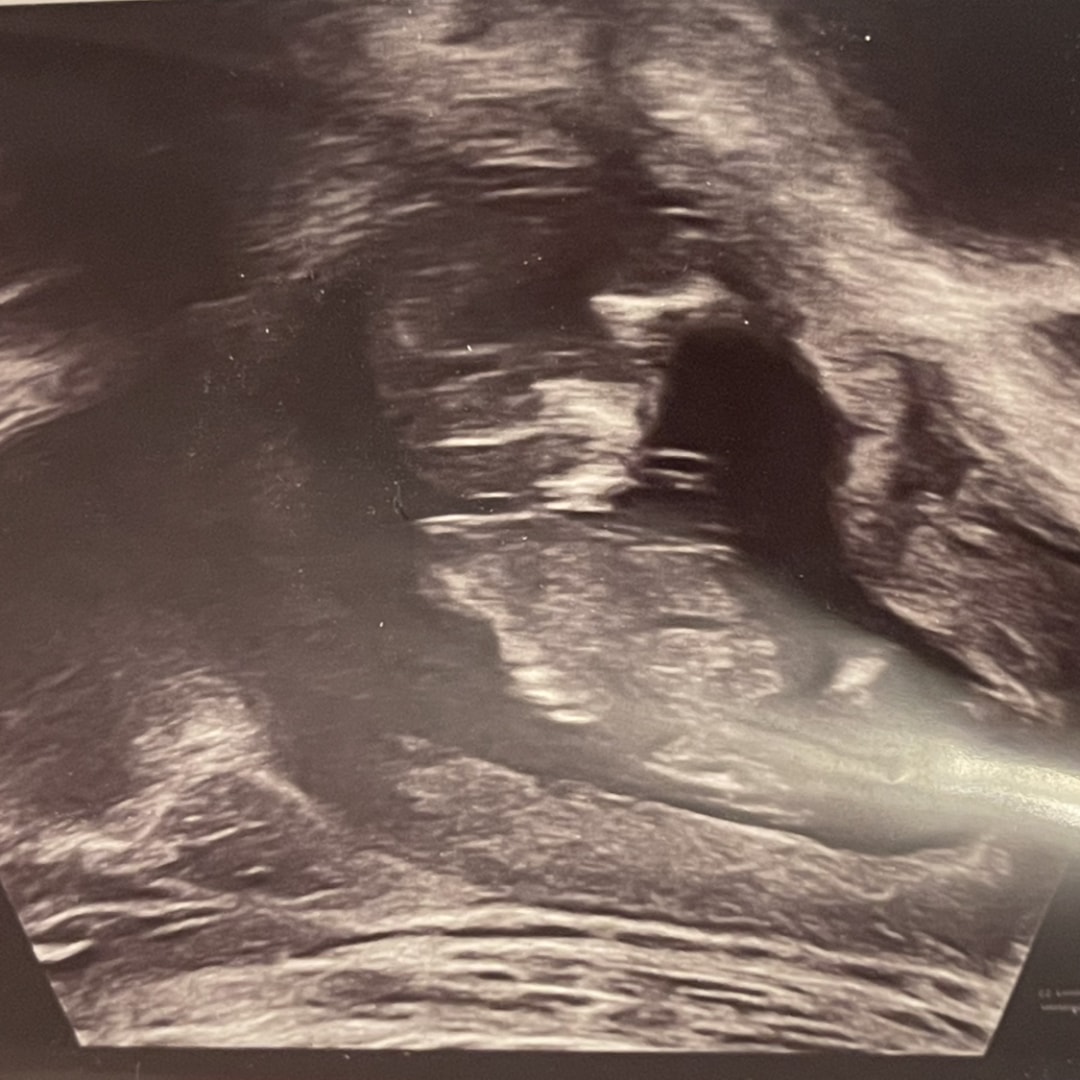 Photo shared by Leeana for their Babylist baby registry.