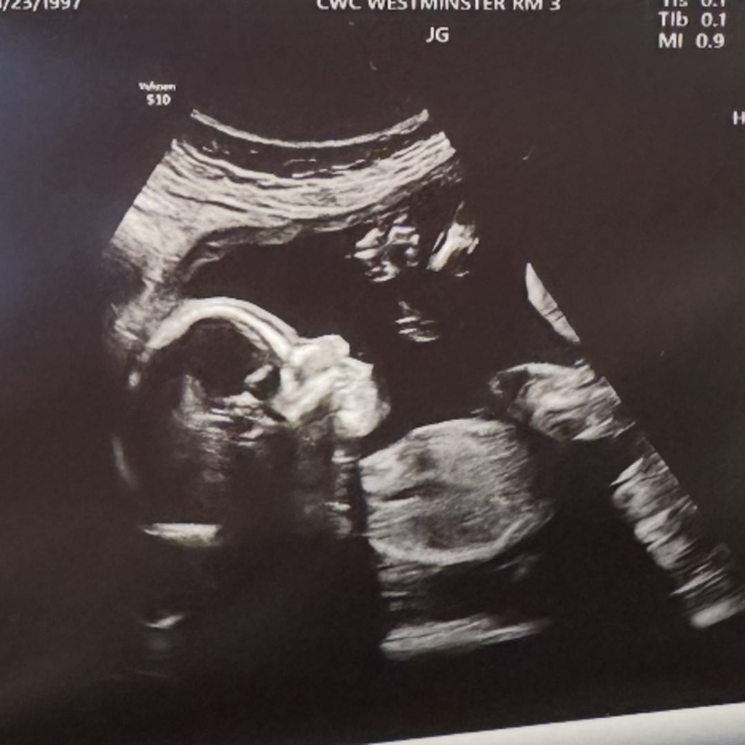 Photo shared by Delshawn for their Babylist baby registry.