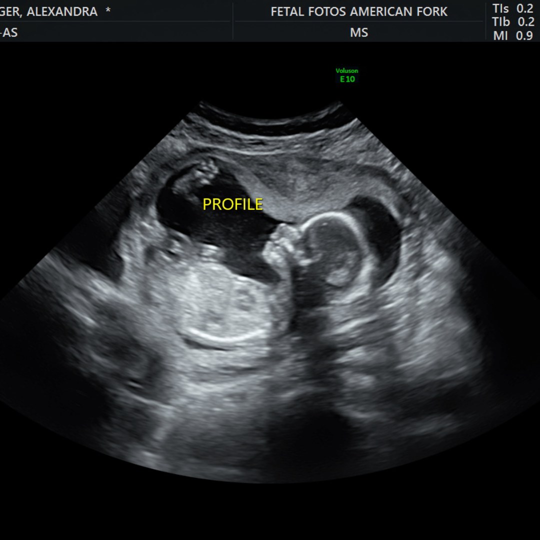 Photo shared by Alexandra for their Babylist baby registry.