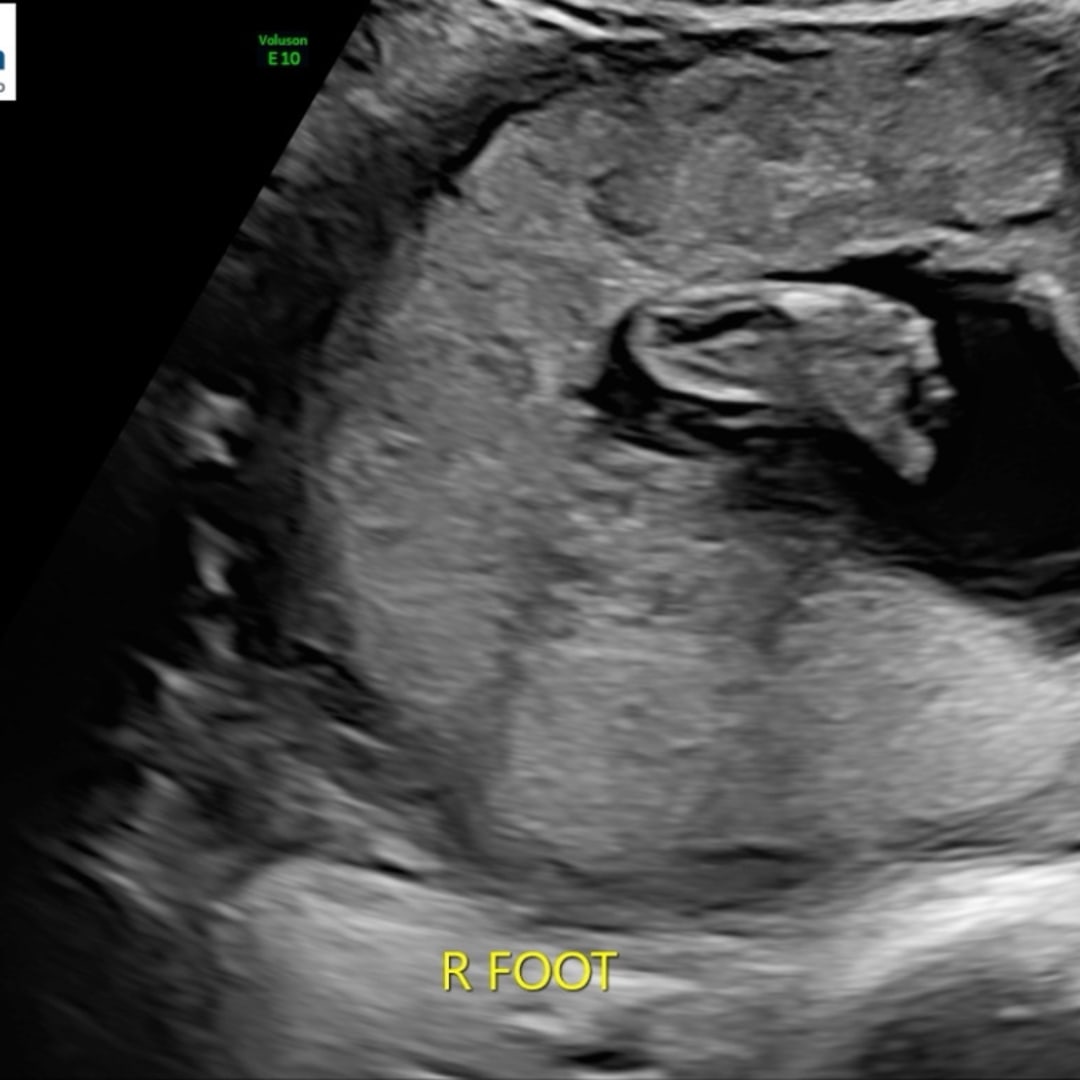 Photo shared by Eileen for their Babylist baby registry.