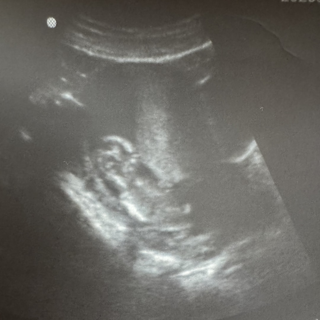 Photo shared by Lauren for their Babylist baby registry.